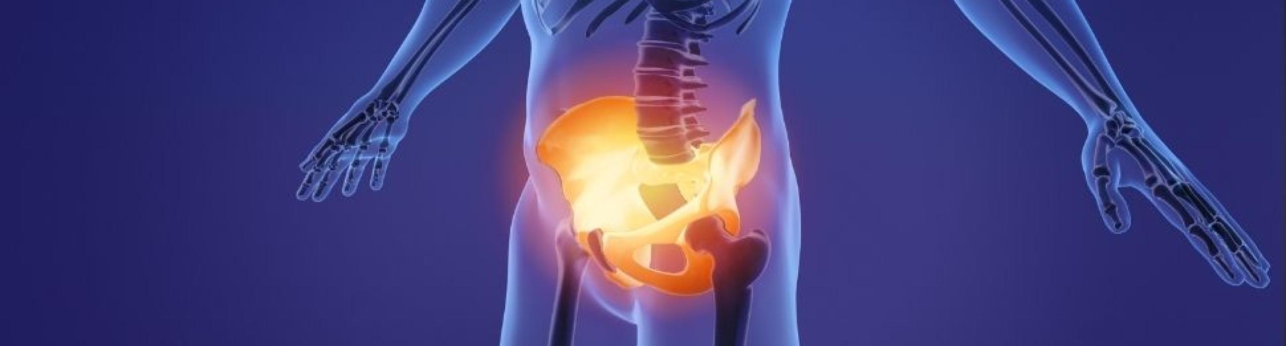 imatge recurs que mostra dolor a la zona del sol pelvic