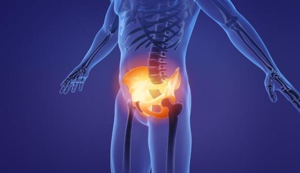 imatge recurs que mostra dolor a la zona del sol pelvic