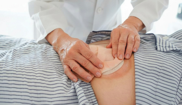 Imatge de recurs d'ostomies